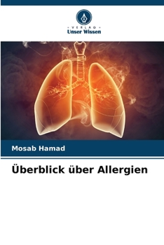 Paperback Überblick über Allergien [German] Book