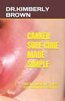 Paperback Canker Sore Cure Made Simple: Actionable Tips on Canker Sore Book