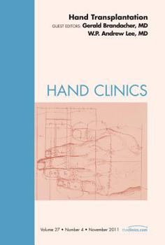 Hardcover Hand Transplantation, an Issue of Hand Clinics: Volume 27-4 Book