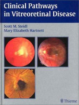 Hardcover Clinical Pathways in Vitreoretinal Disease Book
