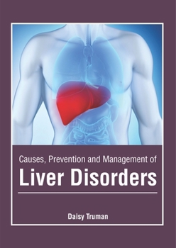 Hardcover Causes, Prevention and Management of Liver Disorders Book
