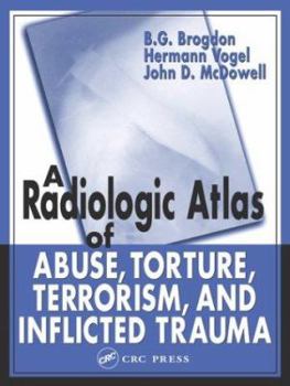 Hardcover A Radiologic Atlas of Abuse, Torture, Terrorism, and Inflicted Trauma Book