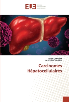 Paperback Carcinomes Hépatocellulaires [French] Book