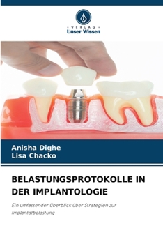 Paperback Belastungsprotokolle in Der Implantologie [German] Book