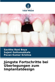 Paperback Jüngste Fortschritte bei Überlegungen zum Implantatdesign [German] Book