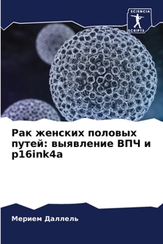 Paperback Рак женских половых путе [Russian] Book