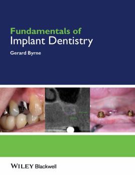 Paperback Fundamentals of Implant Dentistry Book