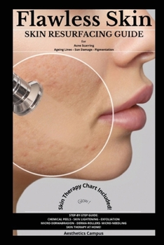 Paperback Flawless Skin: Skin Resurfacing Guide for Acne Scarring - Ageing Lines - Sun Damage - Pigmentation Book
