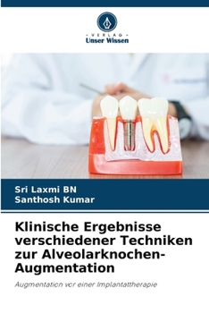 Paperback Klinische Ergebnisse verschiedener Techniken zur Alveolarknochen-Augmentation [German] Book