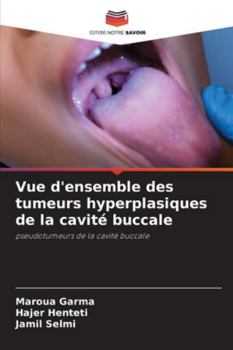 Paperback Vue d'ensemble des tumeurs hyperplasiques de la cavité buccale [French] Book