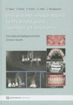 Hardcover Immediate Restorations with a Reduced Number of Implants: Conceptual Background and Clinical Results Book
