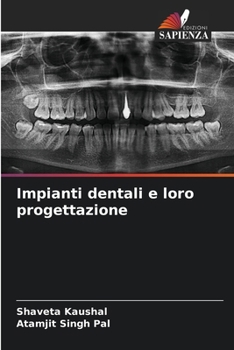 Impianti dentali e loro progettazione (Italian Edition)