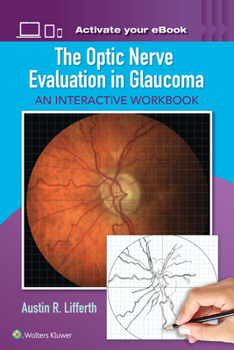 Paperback The Optic Nerve Evaluation in Glaucoma: An Interactive Workbook Book