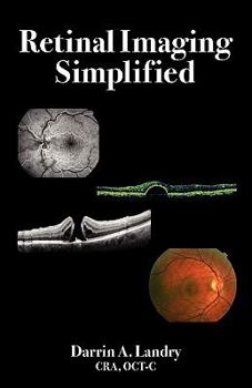 Paperback Retinal Imaging Simplified Book