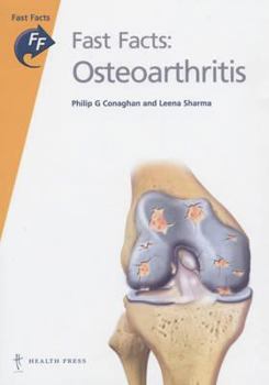 Paperback Fast Facts: Osteoarthritis Book