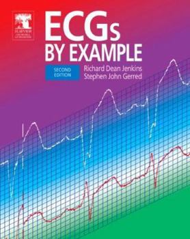 Paperback Ecgs by Example Book