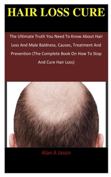 Hair Loss Cure: The Ultimate Truth You Need To Know About Hair Loss And Male Baldness, Causes, Treatment And Prevention (The Complete Book On How To Stop And Cure Hair Loss)