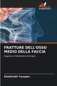 Paperback Fratture Dell'osso Medio Della Faccia [Italian] Book