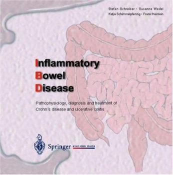 Inflammatory Bowel Disease:  Pathophysiology, Diagnosis And Treatment Of Crohn's Disease And Ulcerative Colitis