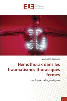 Paperback Hémothorax dans les traumatismes thoraciques fermés [French] Book