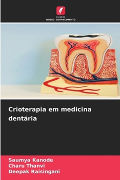 Crioterapia em medicina dentária (Portuguese Edition)