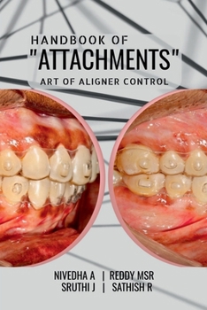 Paperback Handbook of "Attachments": Art of Aligner Control Book