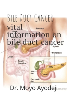 Paperback Bile duct cancer: Vital information on bile duct cancer Book
