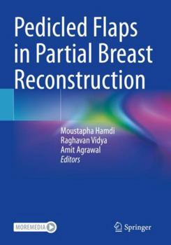 Paperback Pedicled Flaps in Partial Breast Reconstruction Book