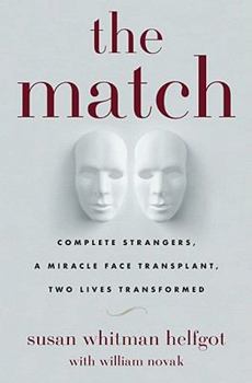 Hardcover The Match: Complete Strangers, a Miracle Face Transplant, Two Lives Transformed Book