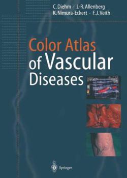 Paperback Color Atlas of Vascular Diseases Book