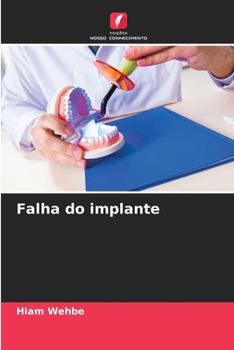 Paperback Falha do implante [Portuguese] Book