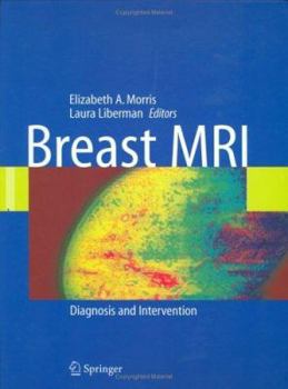 Hardcover Breast MRI: Diagnosis and Intervention Book