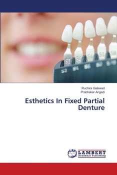 Paperback Esthetics In Fixed Partial Denture Book