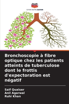 Paperback Bronchoscopie à fibre optique chez les patients atteints de tuberculose dont le frottis d'expectoration est négatif [French] Book