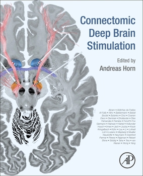 Paperback Connectomic Deep Brain Stimulation Book