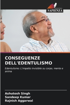 Paperback Conseguenze Dell'edentulismo [Italian] Book