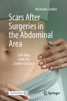 Paperback Scars After Surgeries in the Abdominal Area: Self-Help with the Liedler-Concept Book