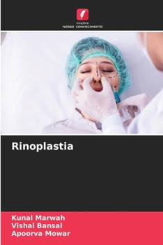 Paperback Rinoplastia [Portuguese] Book