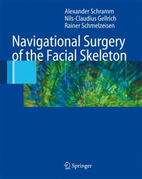 Hardcover Navigational Surgery of the Facial Skeleton Book