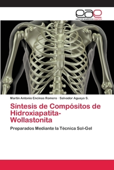 Paperback Síntesis de Compósitos de Hidroxiapatita-Wollastonita [Spanish] Book