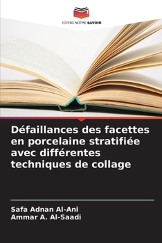 Paperback Défaillances des facettes en porcelaine stratifiée avec différentes techniques de collage [French] Book
