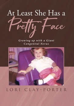 Hardcover At Least She Has a Pretty Face: Growing up with a Giant Congenital Nevus Book