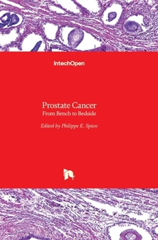 Hardcover Prostate Cancer: From Bench to Bedside Book