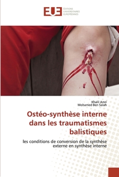 Paperback Ostéo-synthèse interne dans les traumatismes balistiques [French] Book