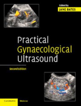 Paperback Practical Gynaecological Ultrasound Book