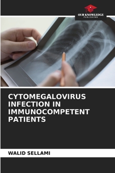 Paperback Cytomegalovirus Infection in Immunocompetent Patients Book