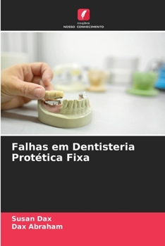 Paperback Falhas em Dentisteria Protética Fixa [Portuguese] Book