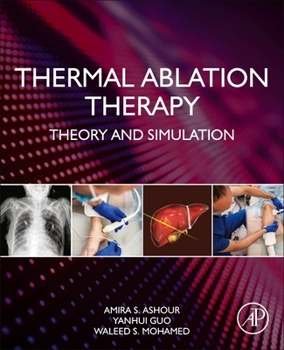 Paperback Thermal Ablation Therapy: Theory and Simulation Book