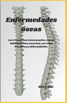 Paperback Enfermedades óseas: Los trastornos óseos pueden causar debilidad ósea anormal, así como fracturas y deformidades. [Spanish] Book