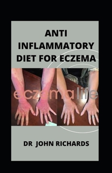 Paperback Anti Inflammatory Diet For Eczema: Diet For Eczema Book